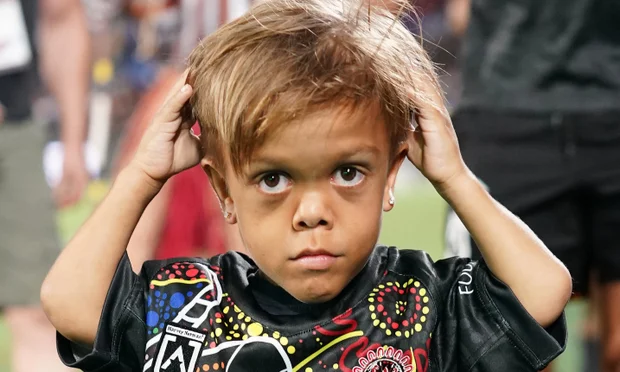 Quaden Bayles Age Revealed: Learn His Exact Birth Year