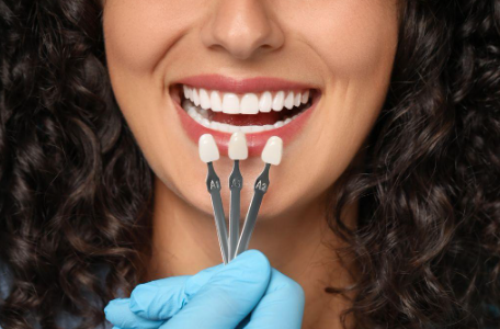 Achieve Your Dream Smile with Porcelain Veneers in Redcliffe