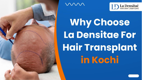 Why Choose La Densitae For Hair Transplant in Kochi